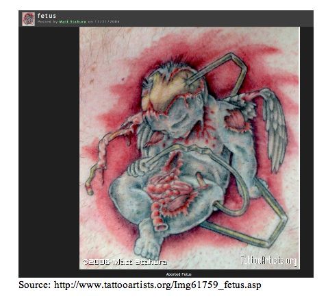 A tattoo of a bloody dead fetus with a coat hanger through it